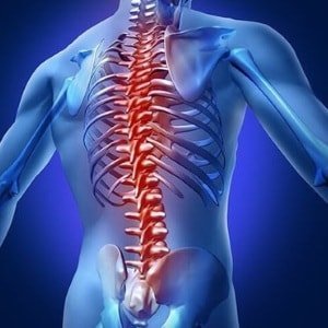 ochorenia chrbtice-stĺpec