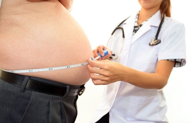 obezita ako príčina artrózy bedrového kĺbu