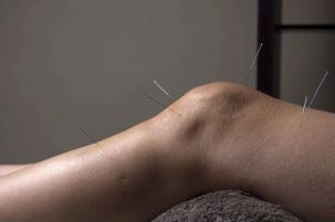 Akupunktúra podporuje opravu kĺbových tkanív