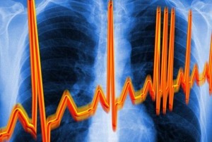 Zmeny a poruchy srdcového rytmu sú znakom cervikálnej osteochondrózy